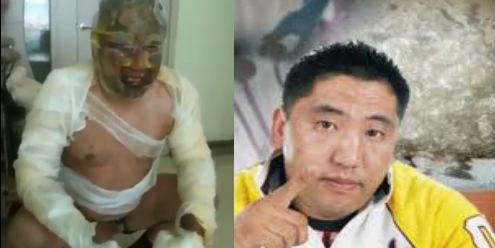 Монголын хип хоп хамтлагууд Бааварын эмчилгээнд зориулж хандивын тоглолт хийнэ